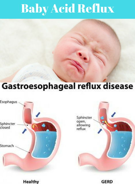 Baby Acid Reflux | Rosa For Life