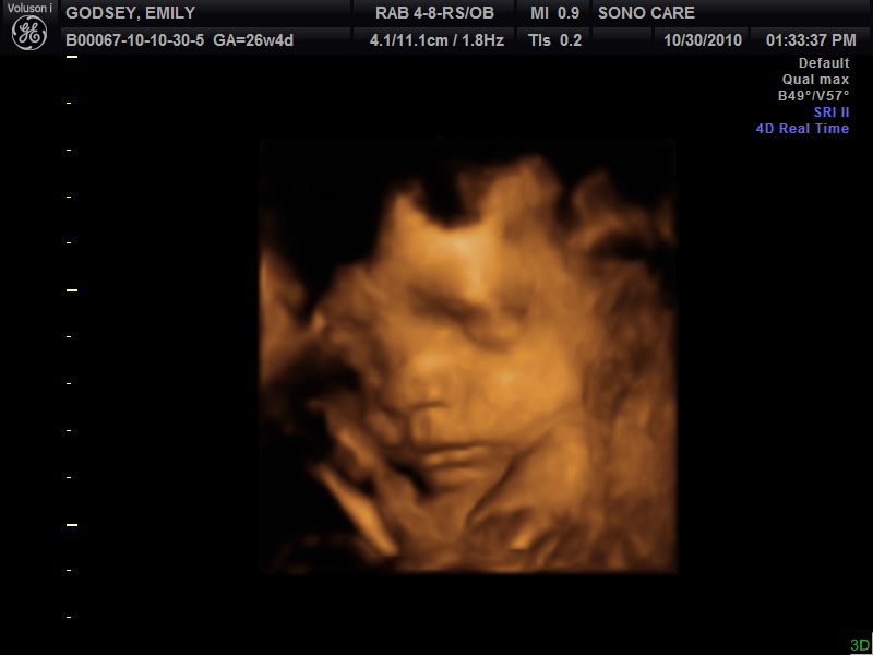 3d ultrasound pictures at 20 weeks. So we went to get our 3d