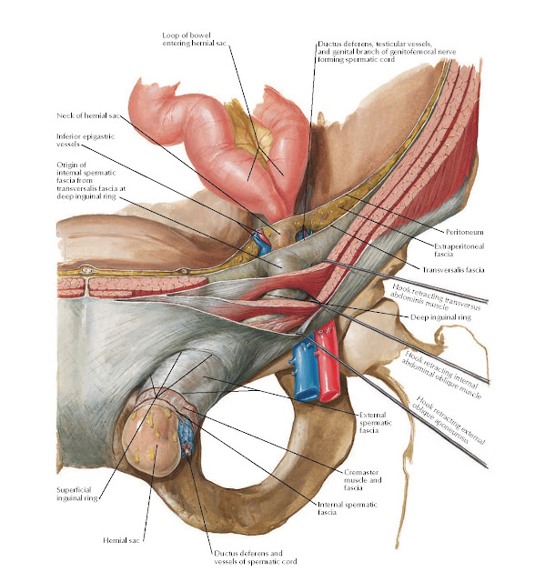 Indirect Inguinal Hernia Anatomy