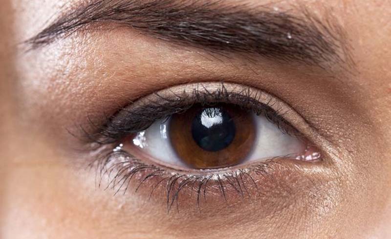  6 Natural Ways to Remove Dark Undereye Circles