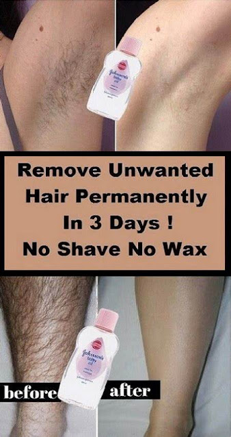 Remove Unwated Hair Permanently In Three Days, No Shave No Wax, Removal Facial & Body Hair Permanently