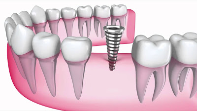 http://www.whitefielddentist.com