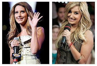 Ashley Tisdale Plastic Surgery