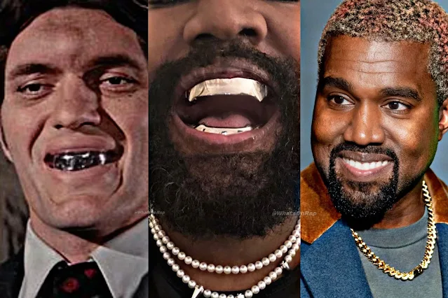 Kanye West Refutes Reports of $850,000 Titanium Dentures Amidst Speculations.