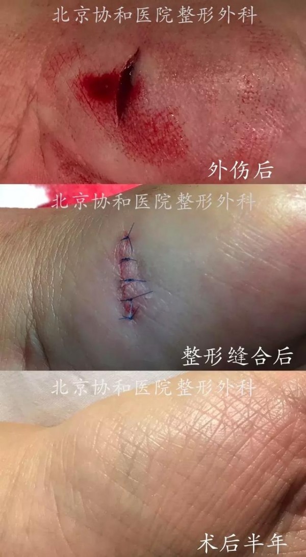 clip_image004