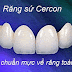 Màu sắc của răng sứ cercon so với răng thật