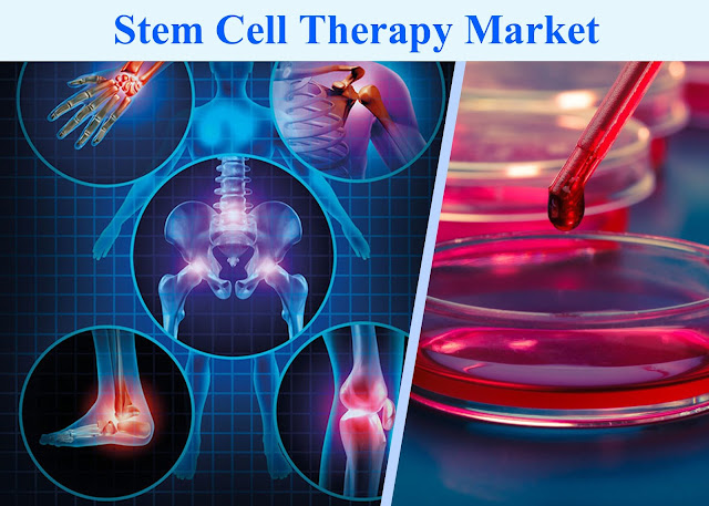 Stem Cells Market