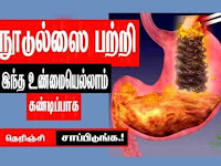  நூடுல்ஸை பற்றி இந்த உண்மையெல்லாம் தெரிஞ்சிக்கிட்டு சாப்பிடுங்க.!