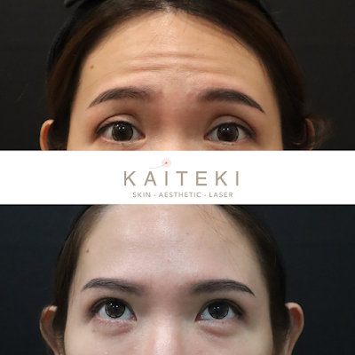 kaiteki skin aesthetic clinic ss2 review