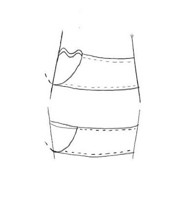 Diagram showing cup wrinkles on an A shaped ribcage and none on a V shaped ribcage