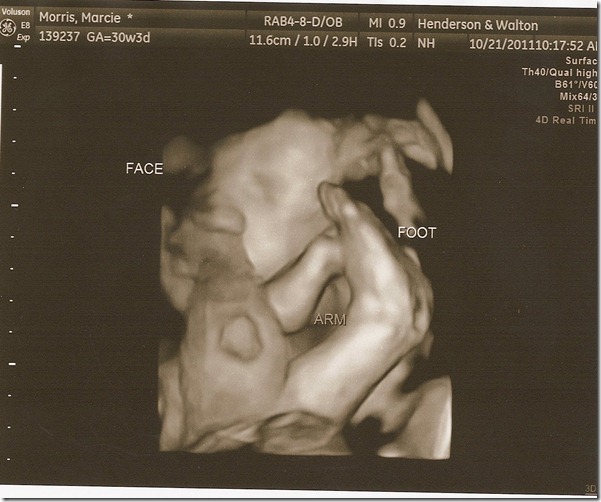 SCAN0096