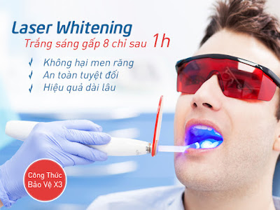 Công nghệ tẩy trắng răng Laser Whitening hàng đầu 