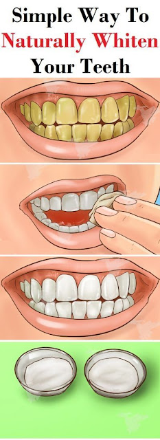 Taking Care Of Your Teeth, Does Not Have To Be Difficult