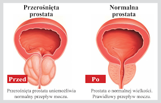 prostabium