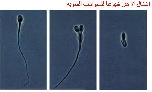 الأشكال الأكثر شيوعاً للحيوانات المنوية