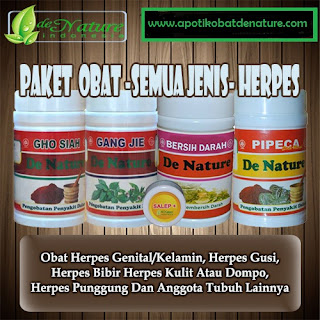 Obat Penyakit Herpes Paling Manjur