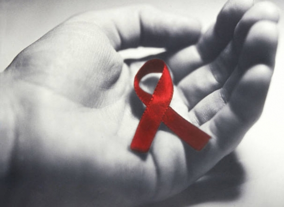 Manifestações reumáticas relacionadas ao HIV (AIDS)