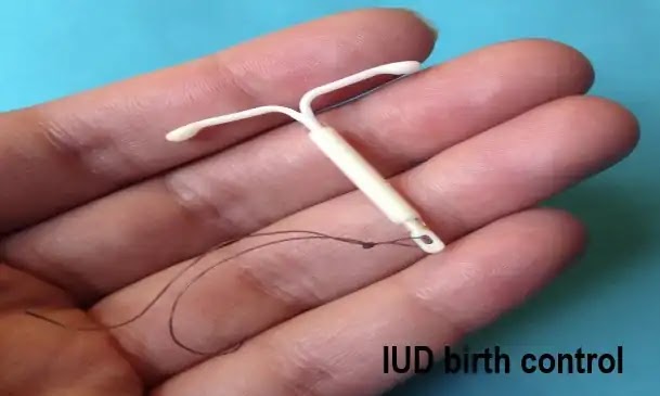 Intrauterine device iud birth control -Your contraception guide