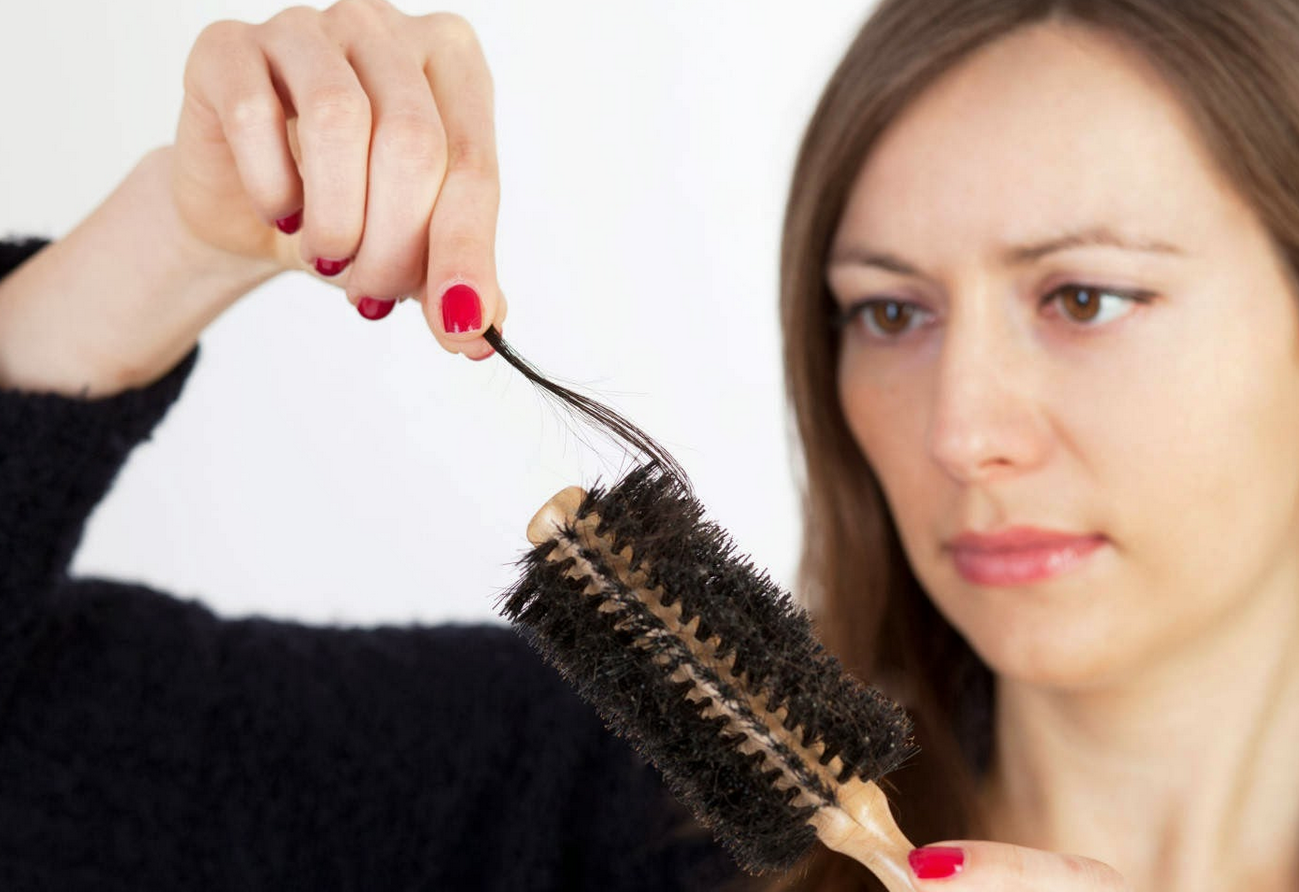 Cara Mengatasi Rambut Rontok Parah Secara Alami Donna Hole