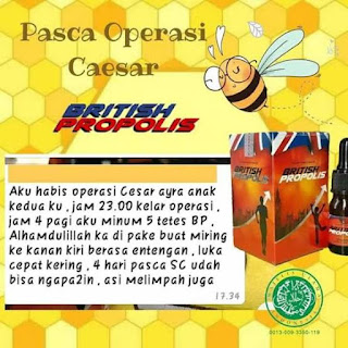 British Propolis untuk Luka Operasi