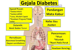 Jual ALGA GOLD CEREAL Obat Herbal Diabetes Ampuh Di Kutai Barat | WA : 0822-3442-9202