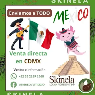 Contacto para adquirir Skinela para cubrir el vitiligo en México