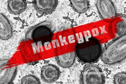 Apa itu Monkeypox, Asal Usul dan Seberapa Bahayanya