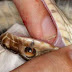 When bitten by a poisonous snake should do?