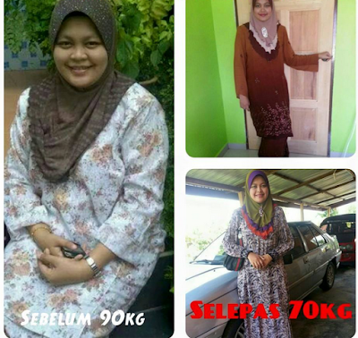 testimoni dz garcinia herbal plus