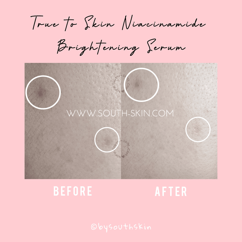 review-truetoskin-niacinamide-brightening-serum