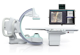 digital subtraction angiography