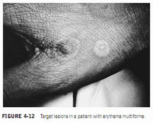 CLINICAL MANIFESTATIONS