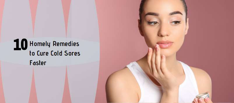 Homely remedies for cure cold sores