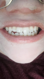 Snow teeth whitening LED