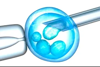 importance of IVF_ichhori.webP