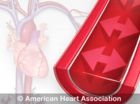 Hipertensi/Tekanan Darah Tinggi, Apa dan Bagaimana 