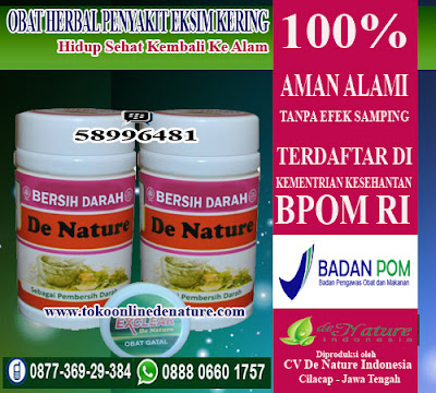 OBAT HERBAL PENYAKIT EKSIM KERING