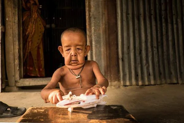 4 Year Old Boy Trapped In An Old Man's Body 