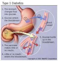 Tanda-tanda Terkena Diabetes