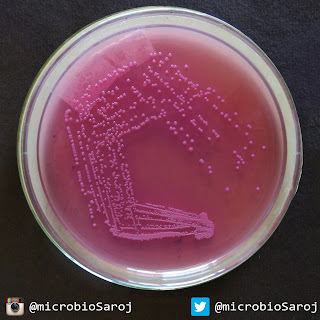 Klebsiella on MacConkey Agar