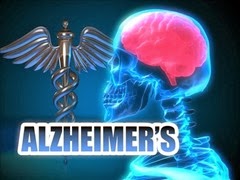 alzheimers_gfx