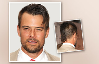 Undercut Hairstyle Men