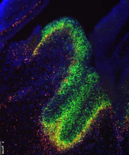 UCSF researchers have uncovered a role in brain development and in neurological disease for little appreciated molecules called long noncoding RNA. In this image, fluorescent dyes track the presence of the RNA molecules and the genes they affect in the developing mouse brain.