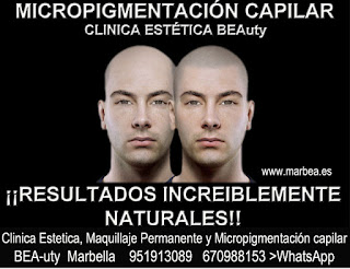 Micropigmentación capilar Mijas CLINICA ESTÉTICA MARBELLA  - uno de los centros más reconocidos, prestigiosos y especializados de España en Marbella 