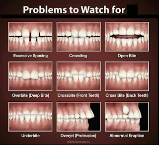 orthodontic trainer - masalah