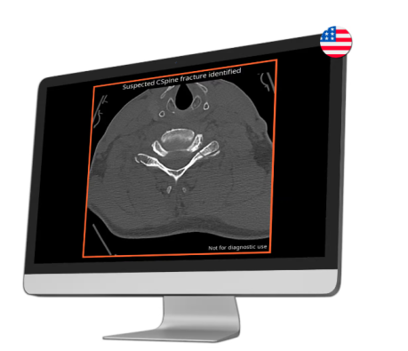 "AI Tool Gains Approval for Detecting Cervical Spine Fractures"