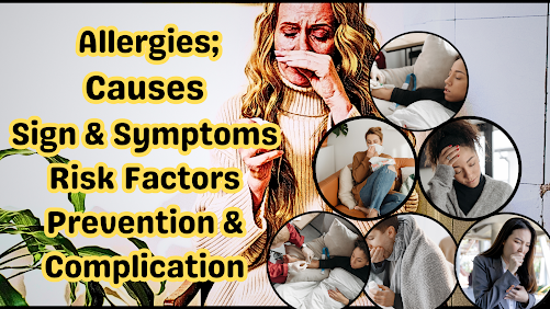 Allergies; Causes, Signs and Symptoms, Risk Factors, Prevention with Complications: