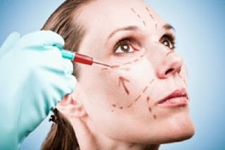 Vampire facelift