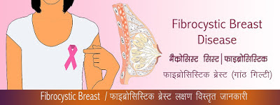 फाइब्रोसिस्टिक ब्रेस्ट , Fibrocystic Breast Disease in Hindi, फाइब्रोसिस्टिक ब्रेस्ट के इलाज के घरेलू , Fibrocystic Breast ka ilaj, chati stan ki ganth ka ilaj, महिलाओ के स्तन गांठ उपाय , स्तन की गांठ ट्रीटमेंट, fibrocystic breast treatment, Female Fibrocystic Breast Home Remedies, mahilaon ki chati ki ganth ka gharelu ilaj