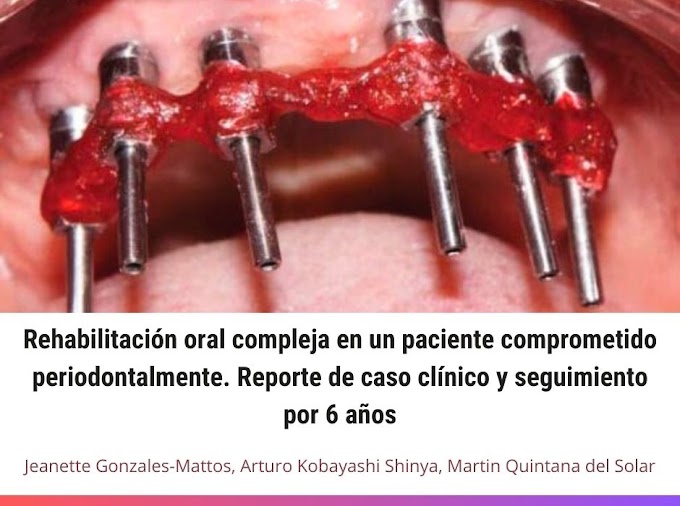 PDF: Rehabilitación oral compleja en un paciente comprometido periodontalmente. Reporte de caso clínico y seguimiento por 6 años